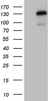 TSHZ1 Antibody (aa29-176, clone OTI2G9)