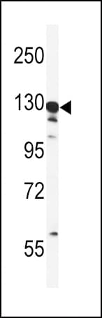 GTSE1 Antibody (aa690-717)