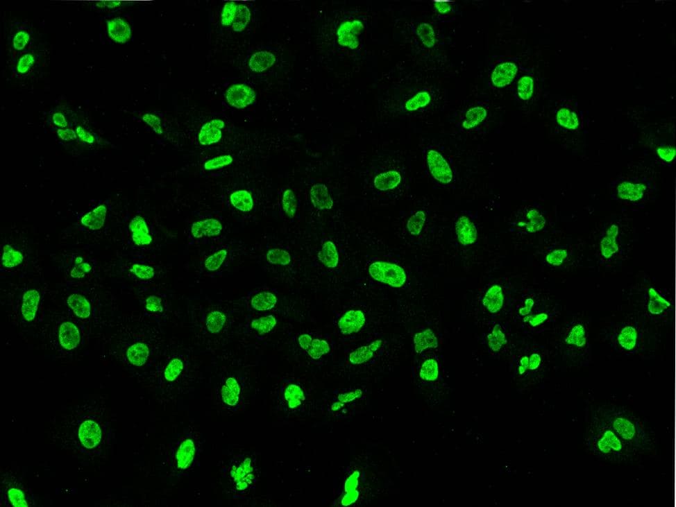 Polyclonal Rabbit anti-Human PAX2 Antibody (Preservative Free, IHC, IF, WB)