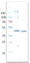 Monoclonal Mouse anti-Bovine ADA / Adenosine Deaminase Antibody (clone 2F5-1D3, WB)