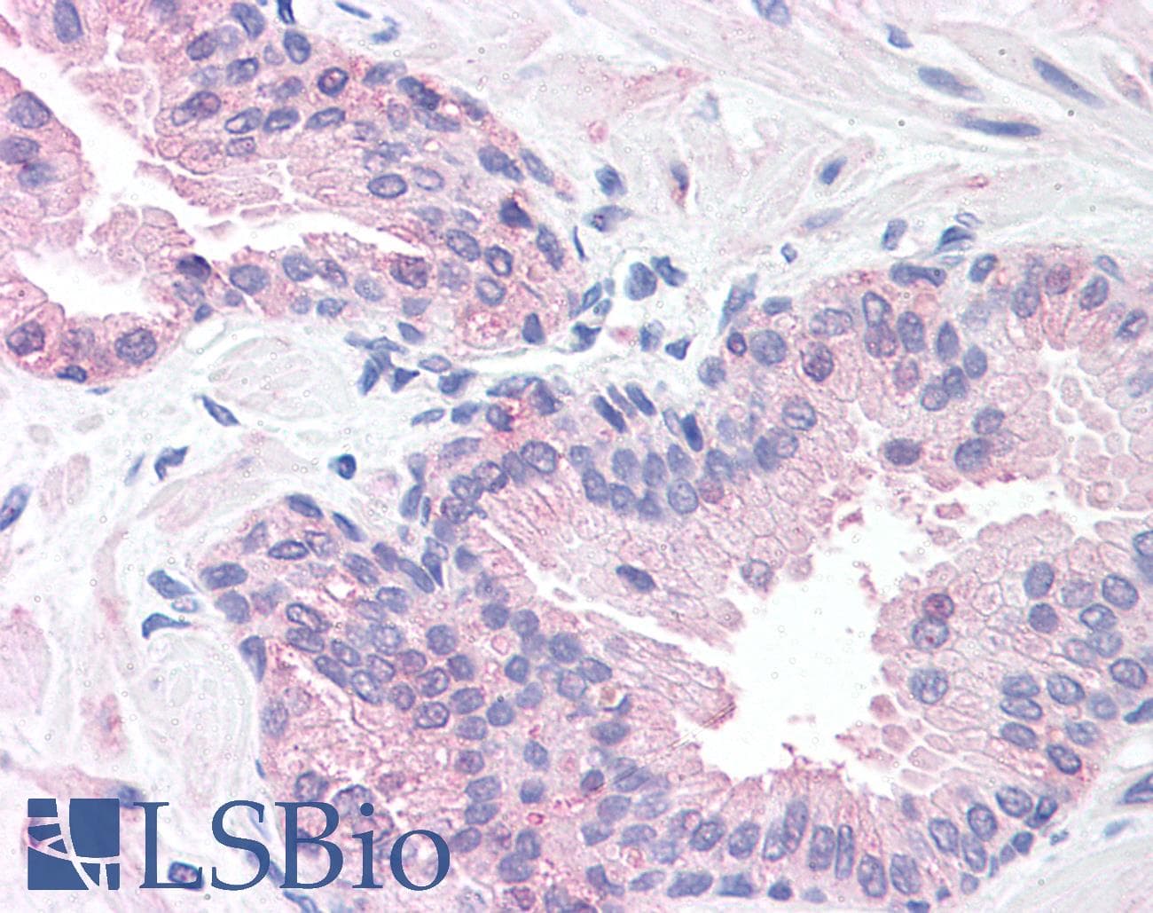 IHC-plus™ Polyclonal Rabbit anti-Human SLITRK6 Antibody (Internal, IHC)