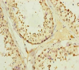 Polyclonal Rabbit anti-Human KIFC3 Antibody (IHC)