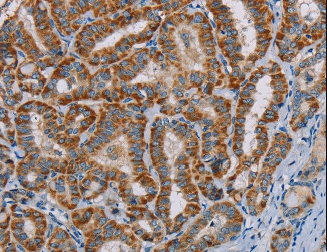 MTCH2 Antibody