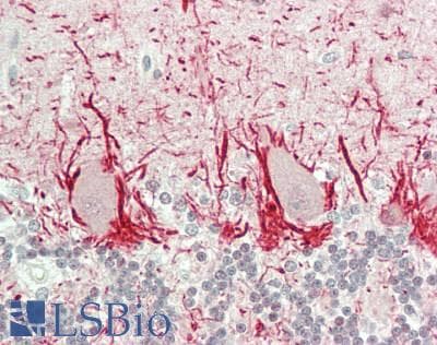 IHC-plus™ Monoclonal Mouse anti-Human PKN1 Antibody (clone 1A4, IHC, WB)