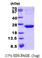 Human p21-ARC / ARPC3 Protein (Recombinant His)