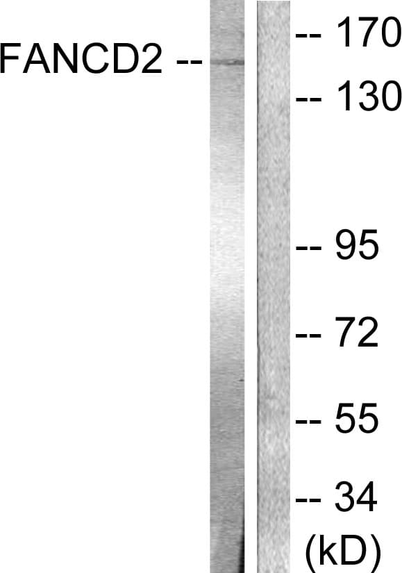 FANCD2 Antibody (aa188-237)