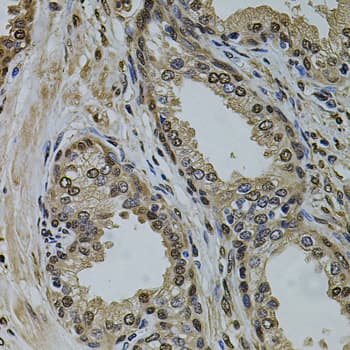 SR140 / U2SURP Antibody