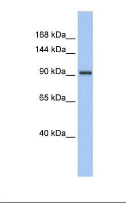 Polyclonal Rabbit anti-Human ZNF295 Antibody (Biotin, aa38-87, WB)
