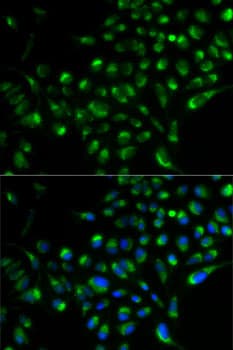 SOD2 / Mn SOD Antibody