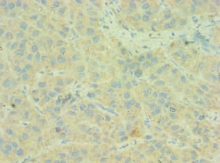 C4BPB / C4BP Beta Antibody (aa18-252)