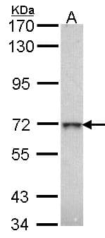 IHC-plus™ Polyclonal Rabbit anti-Human Beta Galactosidase Antibody (aa166-677, IHC, WB)