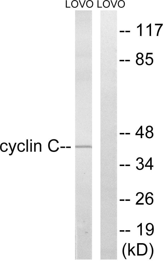 CCNC / Cyclin C Antibody (p275)