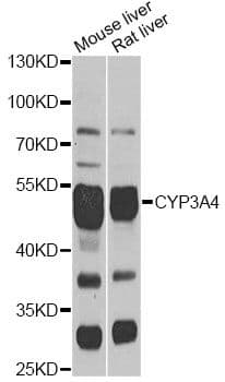 Polyclonal Rabbit anti-Human CYP3A4 / Cytochrome P450 3A4 Antibody (WB)
