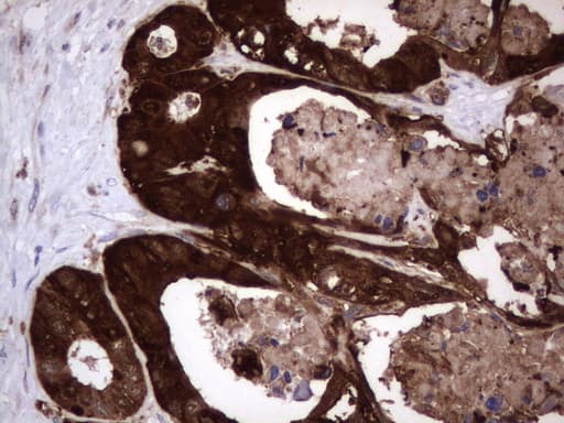 LGALS3 / Galectin 3 Antibody (clone UMAB157, Carrier-free)