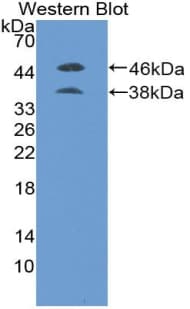 PGF / PLGF Antibody (aa19-158)