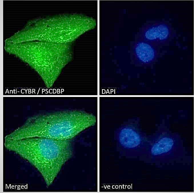 IHC-plus™ CYTIP Antibody (aa2-14)
