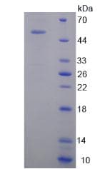 Human SRSF2 / SC35 Protein (Recombinant His-GST)