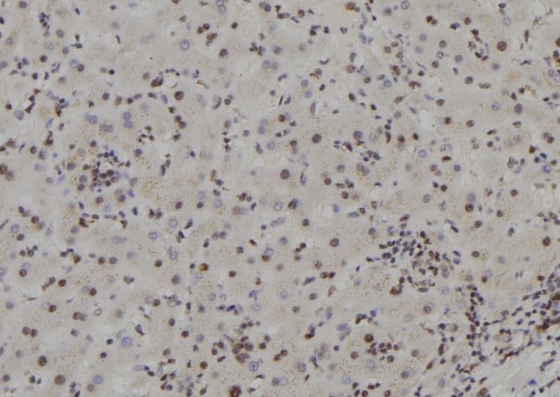 APRT Antibody