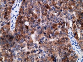EPHX2 / Epoxide Hydrolase 2 Antibody (clone OTI1H5)