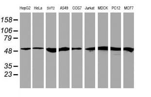 Monoclonal Mouse anti-Human RNF113B Antibody (clone OTI7A1, IHC, IF, WB)