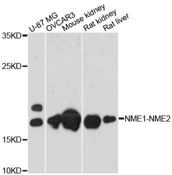NME1-NME2 Antibody