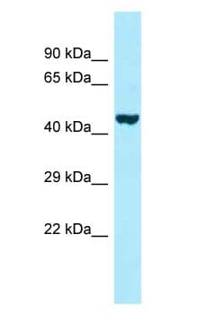 PROKR2/Prokineticin Receptor 2 Antibody (C-Terminus)