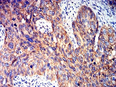 PRKAB2 / AMPK Beta 2 Antibody (clone 8F5B2)