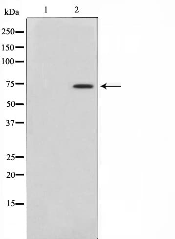 AKAP10 Antibody