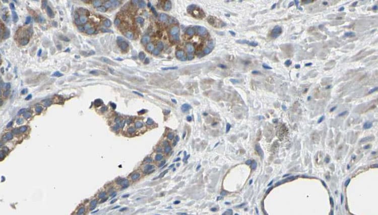 EIF3D Antibody