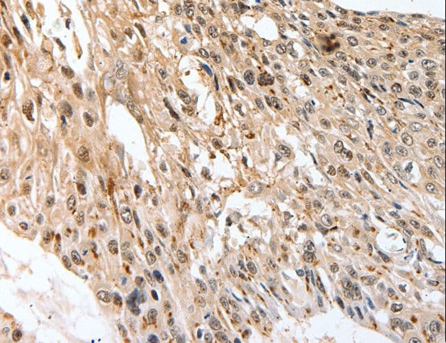 Polyclonal Rabbit anti-Human SLC1A7 / EAAT5 Antibody (IHC)