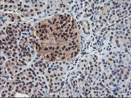 COPS5 / JAB1 Antibody (clone OTI2B12)