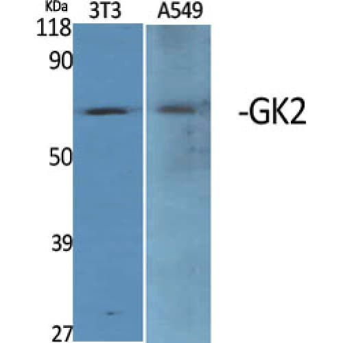 GK2 / Glycerol Kinase 2 Antibody (250-330 aa, Internal)
