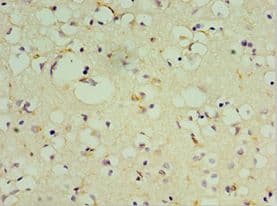 Polyclonal Rabbit anti-Human DRD3 / Dopamine Receptor D3 Antibody (aa213-329, IHC, WB)