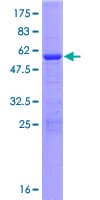 Human ABHD17B / FAM108B1 Protein (Recombinant GST)