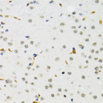 Polyclonal Rabbit anti-Human ESET / SETDB1 Antibody (IHC, WB)