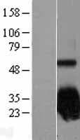 SOD2 / Mn SOD Protein (Over-Expression Lysate Myc-DDK (Flag))