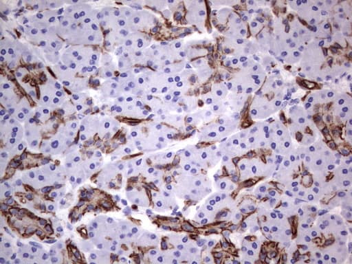 MCAM / CD146 Antibody (clone UMAB155)