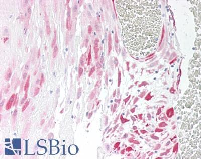 IHC-plus™ VPS45 Antibody (aa558-570)