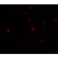 IHC-plus™ TGM7 / Transglutaminase 7 Antibody
