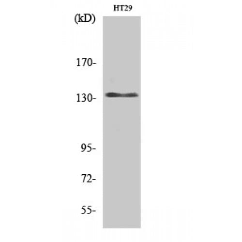 Polyclonal Rabbit anti-Human LIG1 / DNA Ligase 1 Antibody (80-160 aa, N-terminal, IHC, WB)