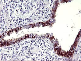 SERPINB3 Antibody (clone OTI1F10)