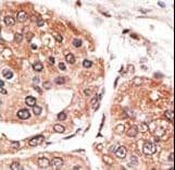 SMYD5 Antibody (aa341-371)
