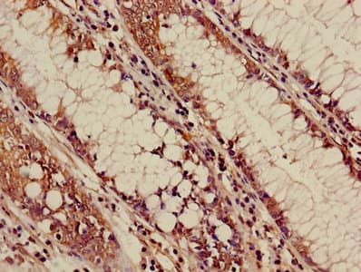 Polyclonal Rabbit anti-Human ALOX5 / 5-LOX Antibody (IHC)
