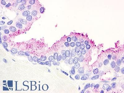 PathPlus™ Polyclonal Rabbit anti-Human GPR21 Antibody (Cytoplasmic Domain, IHC)