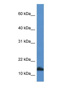 CDA / Cytidine Deaminase Antibody (C-Terminus)