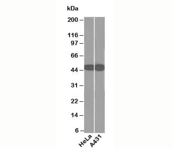 Cytokeratin 1+8 Antibody (clone DC10, Ready-to-Use)