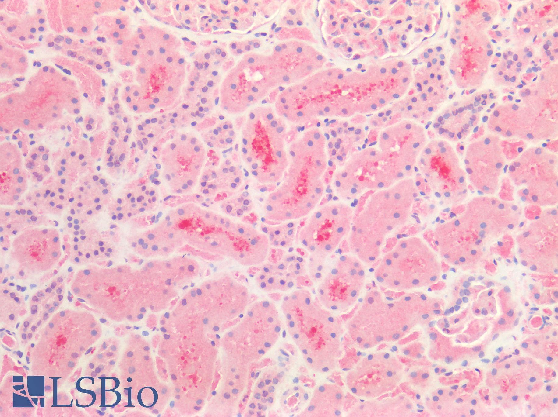 PathPlus™ Polyclonal Rabbit anti-Human MAPT / Tau Antibody (IHC, WB)
