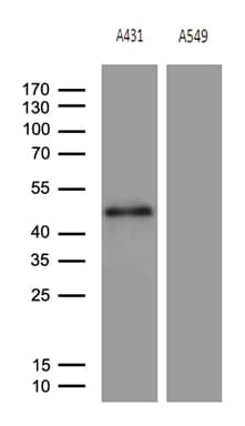 ELF3 / ESE1 Antibody (aa175-286, clone OTI2G6, Carrier-free)