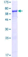 Human IFT52 Protein (Recombinant GST)