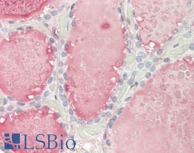 CD32B Antibody (C-Terminus)